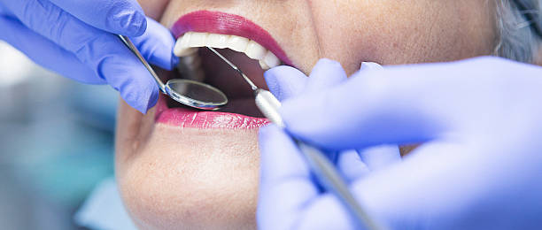 Best Urgent Care for Lost Fillings or Crowns in South Farmingdale, NY